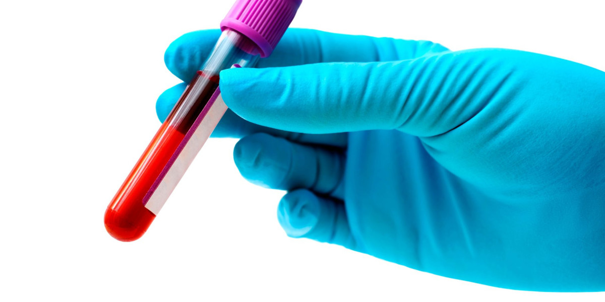 Laboratory Testing for Varicella-Zoster Virus VZV Chickenpox Varicella