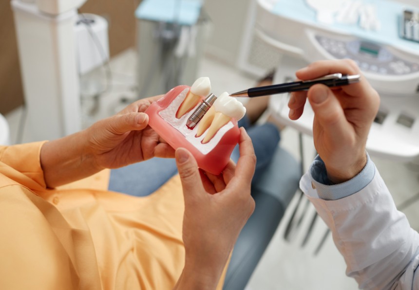 Blogs - Bang Box online - The Step-by-Step Process of Getting Implant-Supported Dentures